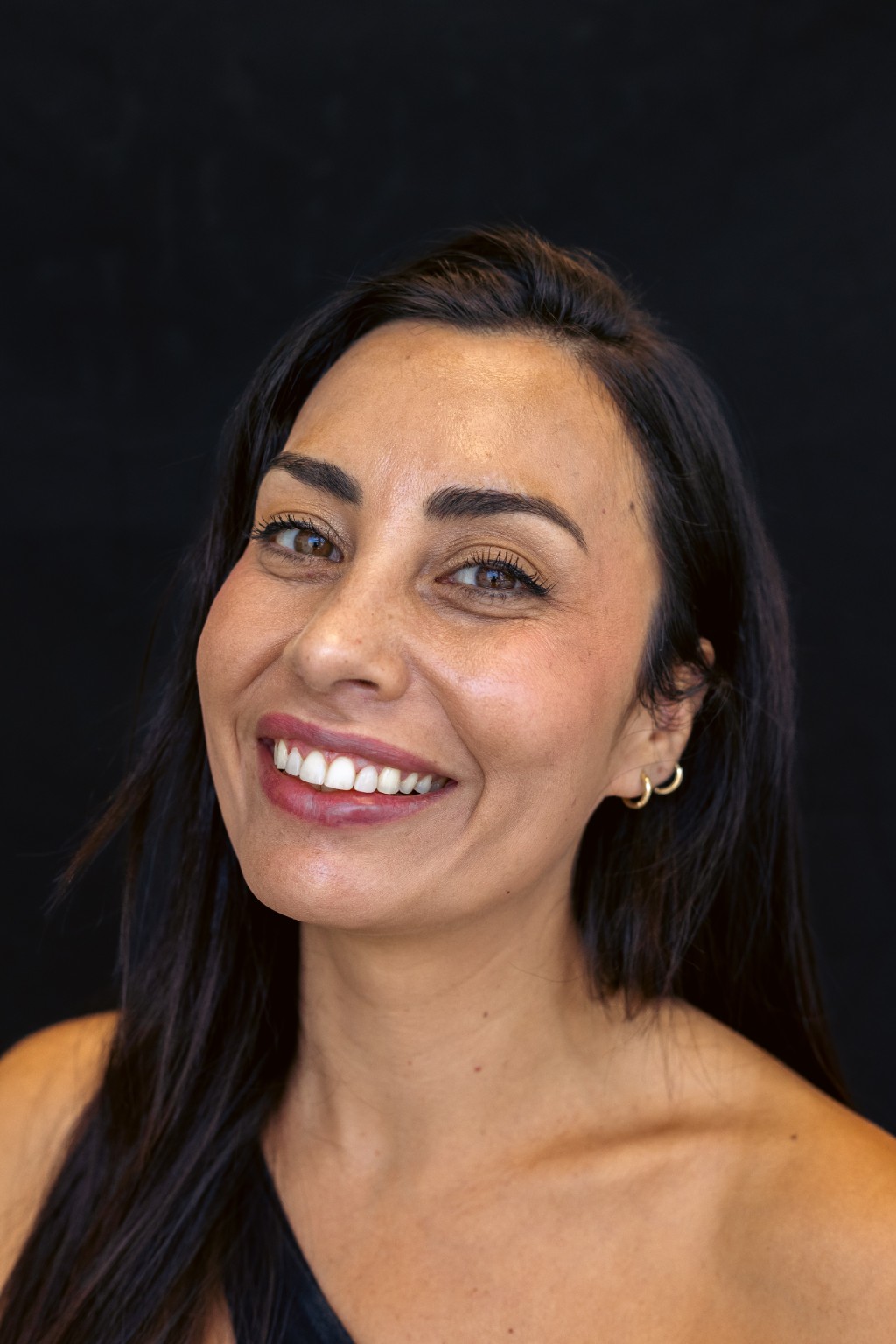 Resultado estético dental realizado en Luxe Dental Care